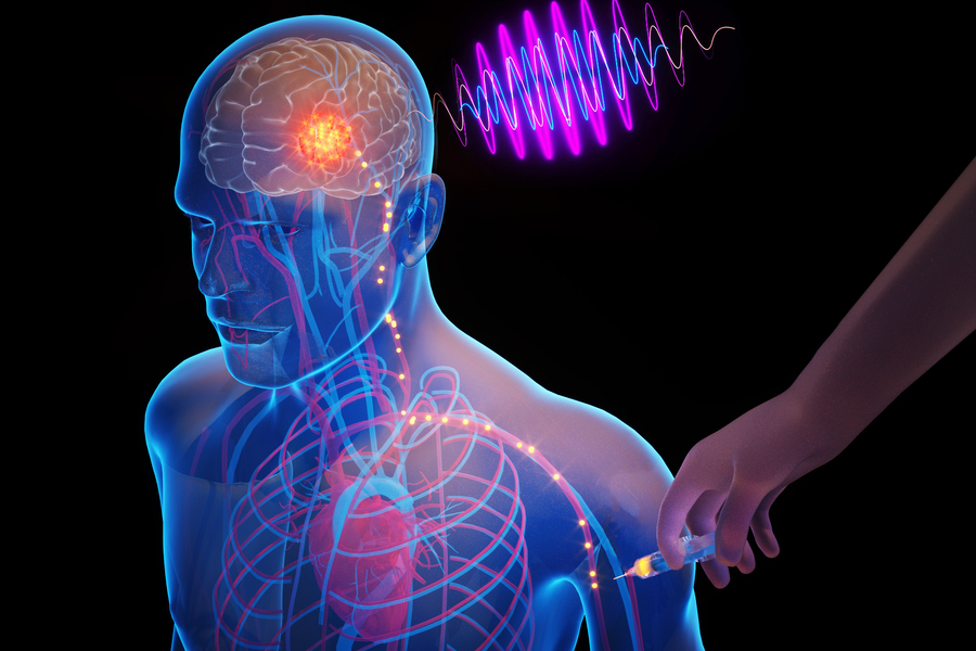 Revolutionary Wireless Implants for Non-Invasive Brain Disease Treatment