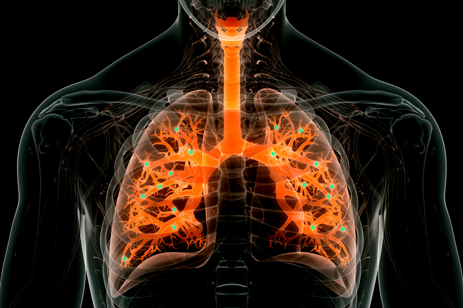 Innovative Nanoparticles for Lung mRNA Delivery