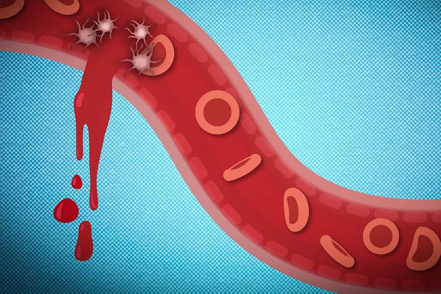 Nanoparticles stopping bleeding illustration