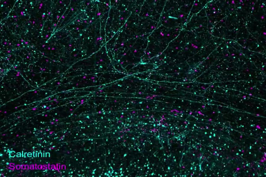 Megatome slicing brain hemisphere